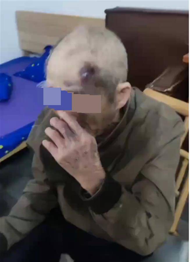 hga030.com手机登录_广东阳江一养老院护工长期虐待九旬老人?民政局已介入hga030.com手机登录,警方:正了解情况