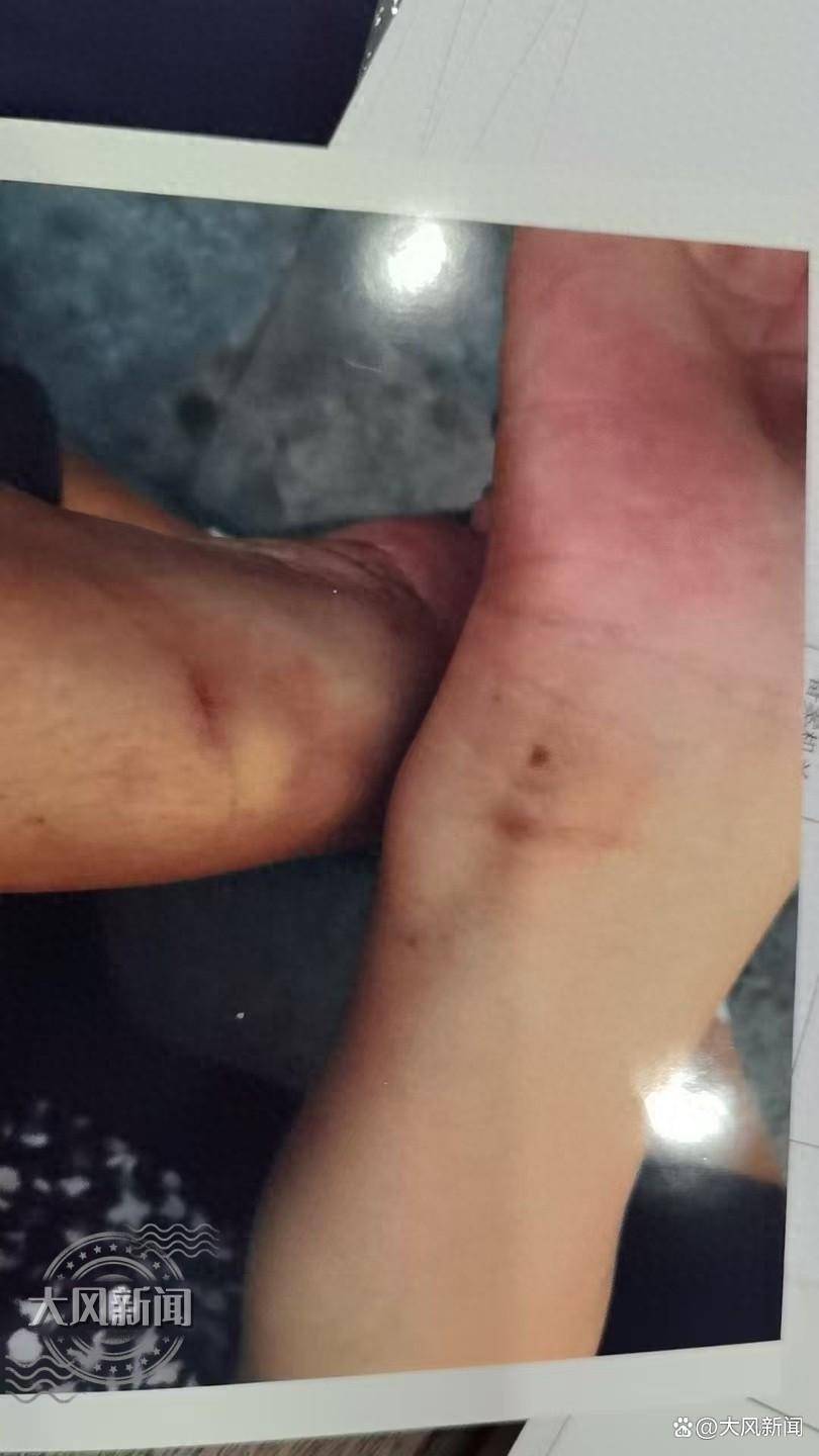 皇冠信用網代理登1
_36岁儿子在浴场宿舍突身亡皇冠信用網代理登1
,母亲为讨说法遭背铐受伤?当地警方否认执法存在问题