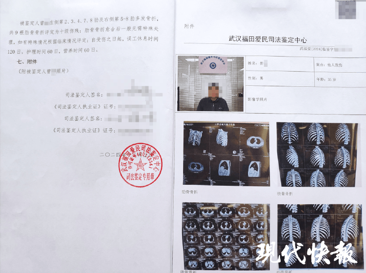 波尔图_湖北一男子称被交警打断9根肋骨未立案波尔图,警方回应