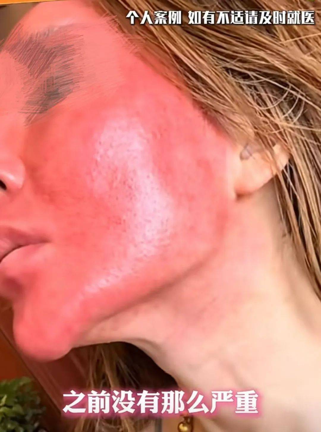 巴黎圣日耳曼vs迈阿密国际_太吓人!女子化妆20年没有卸妆巴黎圣日耳曼vs迈阿密国际,脸竟然变这样!网友:她怎么能忍住