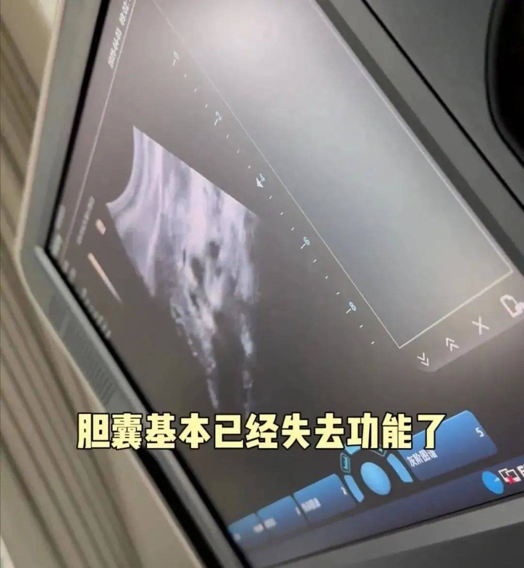 澳大利亚(女) v 荷兰(女)
_36岁知名女演员确诊澳大利亚(女) v 荷兰(女)
!“已基本失去功能”