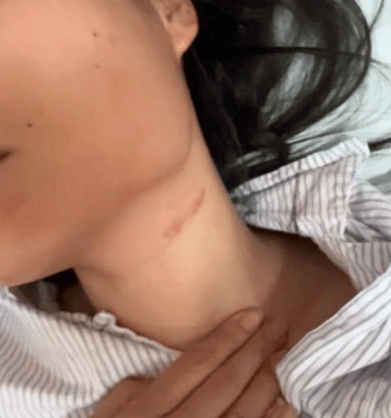 皇冠信用网最高占成_太猖狂了皇冠信用网最高占成,女子与面试官争辩后,被骗至厕所遭殴打,堪比黑势力