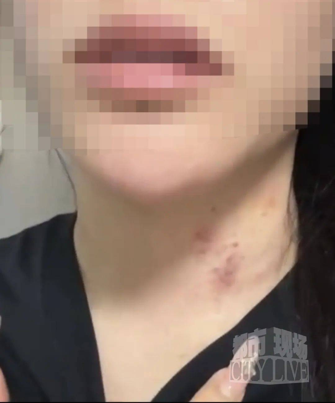 皇冠信用盘如何注册_湖南衡阳29岁女子疑被男友施暴后从25楼跳下身亡 男友徐某此前还刺激说:“你放心皇冠信用盘如何注册,她不会去死的”