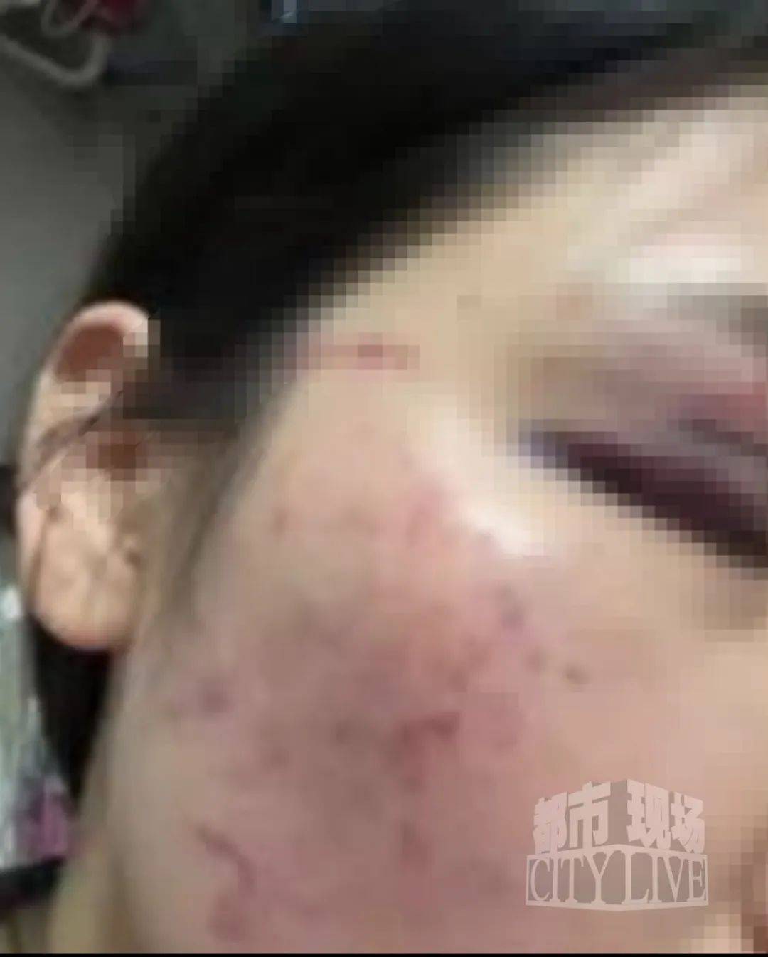 皇冠信用盘如何注册_湖南衡阳29岁女子疑被男友施暴后从25楼跳下身亡 男友徐某此前还刺激说:“你放心皇冠信用盘如何注册,她不会去死的”