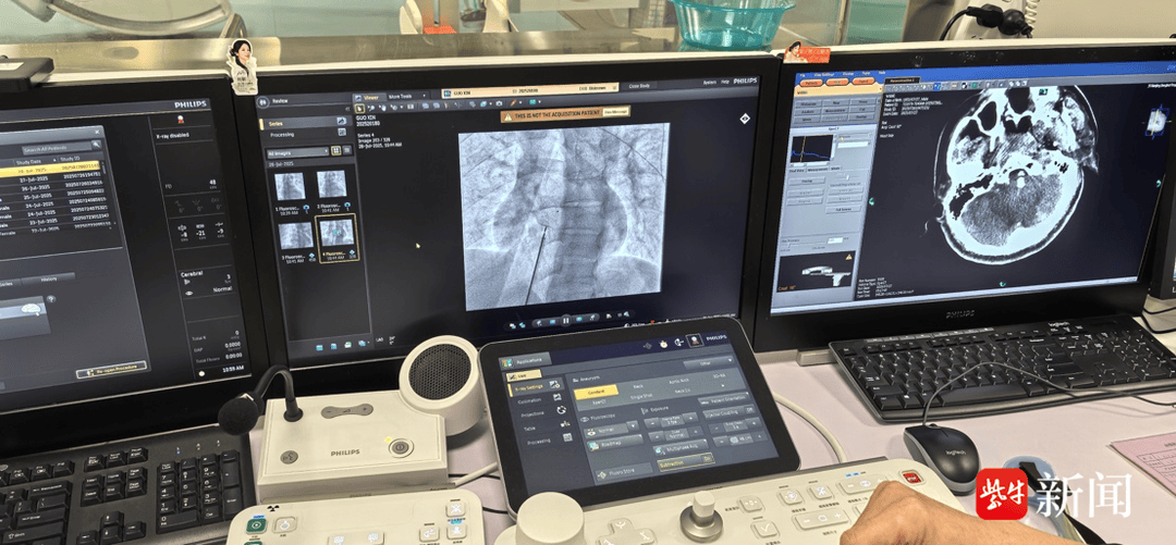 皇冠足球会员注册_36岁青年男性突发脑梗死皇冠足球会员注册,病因竟是心脏上有个“洞”!