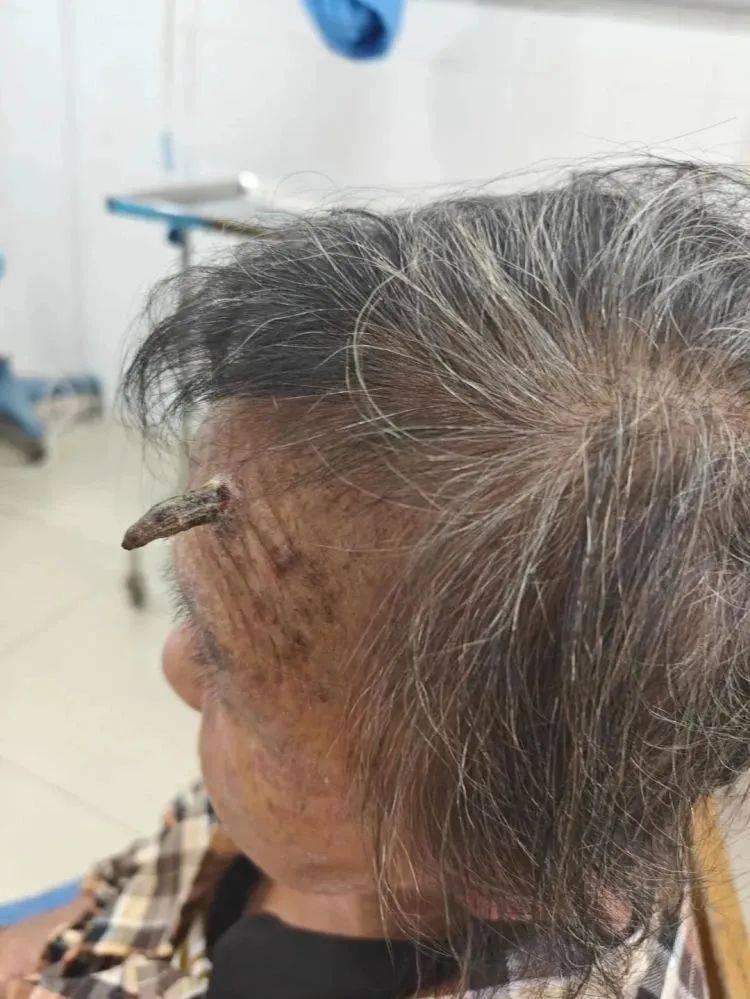 捷克甲组联赛
_太突然!上海98岁阿婆拿起剪刀捷克甲组联赛
,一把剪掉头上的“角”!网友:对自己够狠