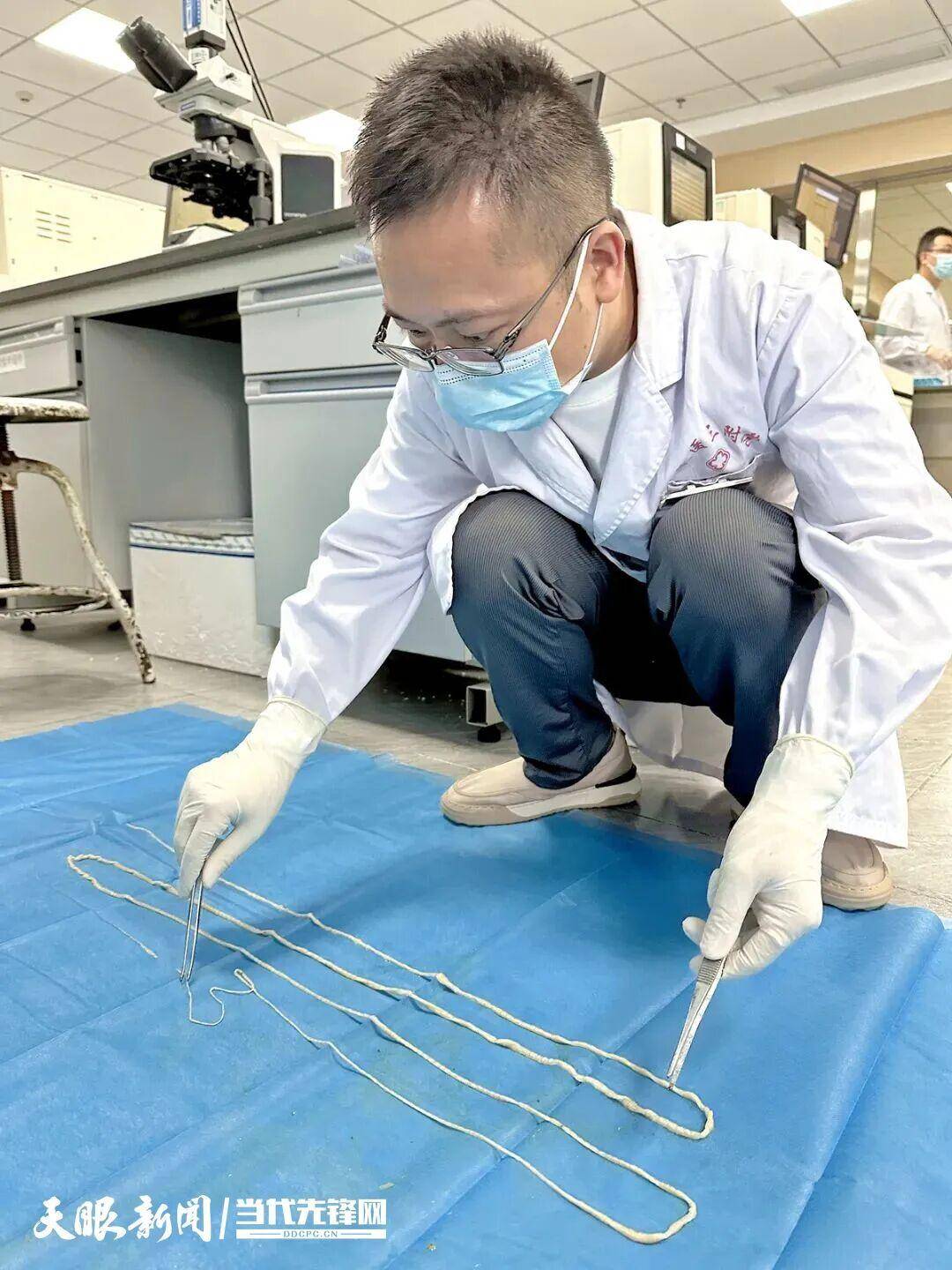 土耳其甲组联赛_最长4米!贵州一男子连续7个月排出“面条状异物”土耳其甲组联赛,医生:很可能和吃这种生食有关