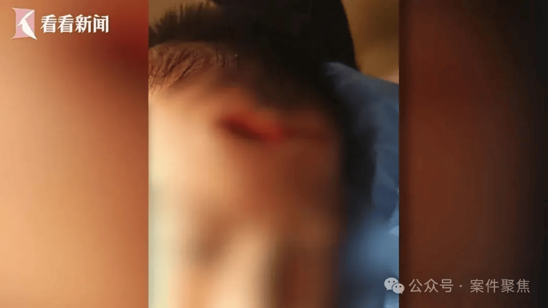 皇冠信用盘网址_血流不止皇冠信用盘网址，脸上缝30多针需整容！上海一知名火锅店发生意外，顾客和商家互相指责……