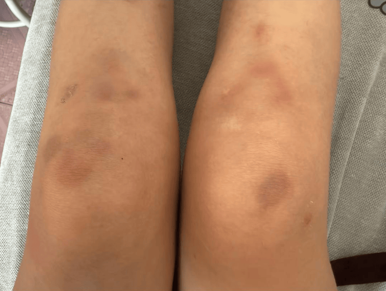 葡萄牙丙组联赛_女子自称因工资问题被老板锁办公室里打 警方:双方已到派出所葡萄牙丙组联赛,是否打人还在调查